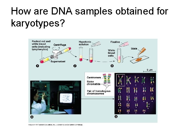 How are DNA samples obtained for karyotypes? How are DNA samples obtained for karyotypes?