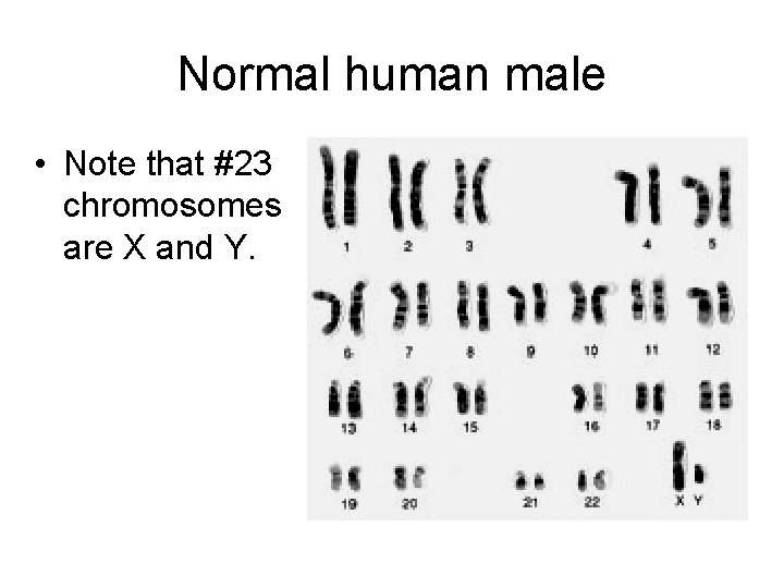 Normal human male • Note that #23 chromosomes are X and Y. Normal human male • Note that #23 chromosomes are X and Y.