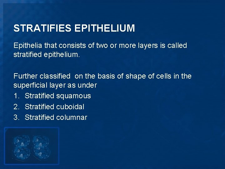 STRATIFIES EPITHELIUM Epithelia that consists of two or more layers is called stratified epithelium.