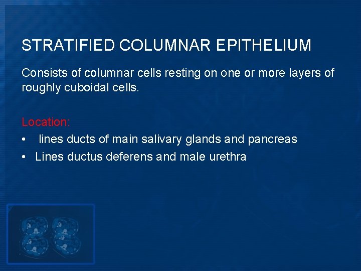 STRATIFIED COLUMNAR EPITHELIUM Consists of columnar cells resting on one or more layers of