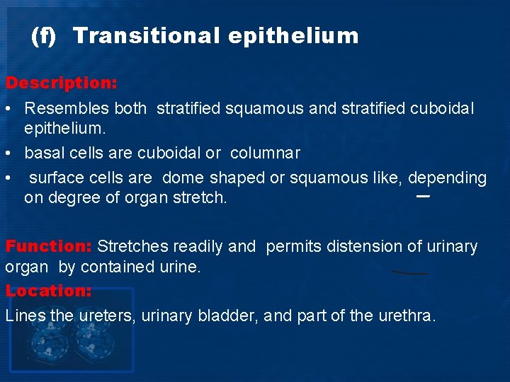 (f) Transitional epithelium Description: • Resembles both stratified squamous and stratified cuboidal epithelium. •
