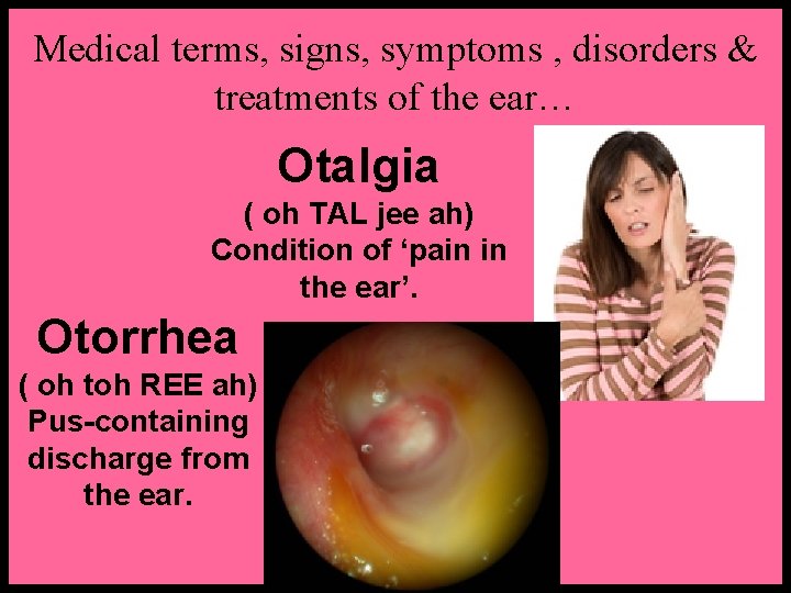 Medical terms, signs, symptoms , disorders & treatments of the ear… Otalgia ( oh