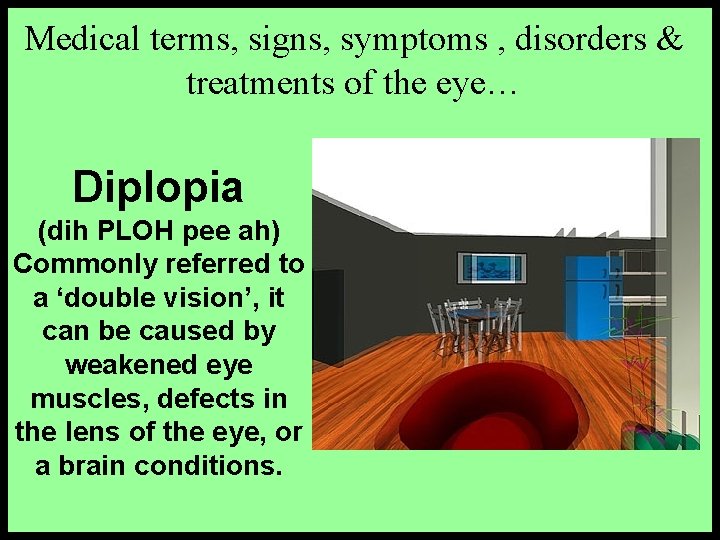 Medical terms, signs, symptoms , disorders & treatments of the eye… Diplopia (dih PLOH