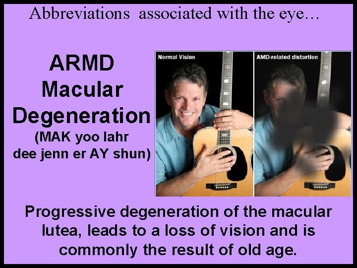 Abbreviations associated with the eye… ARMD Macular Degeneration (MAK yoo lahr dee jenn er