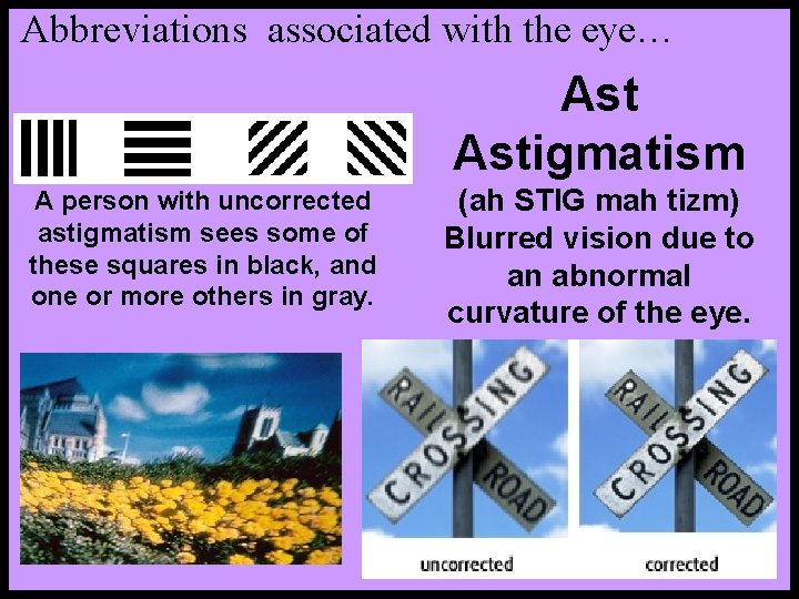 Abbreviations associated with the eye… Astigmatism A person with uncorrected astigmatism sees some of