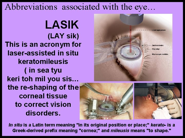 Abbreviations associated with the eye… LASIK (LAY sik) This is an acronym for laser-assisted