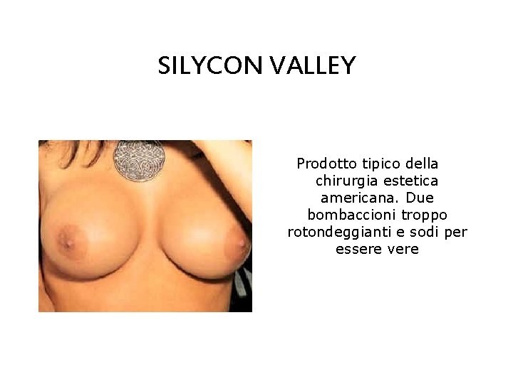 SILYCON VALLEY Prodotto tipico della chirurgia estetica americana. Due bombaccioni troppo rotondeggianti e sodi