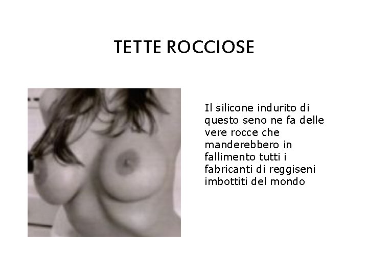 TETTE ROCCIOSE Il silicone indurito di questo seno ne fa delle vere rocce che