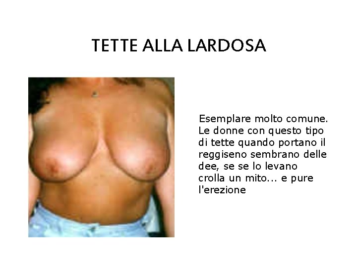 TETTE ALLA LARDOSA Esemplare molto comune. Le donne con questo tipo di tette quando