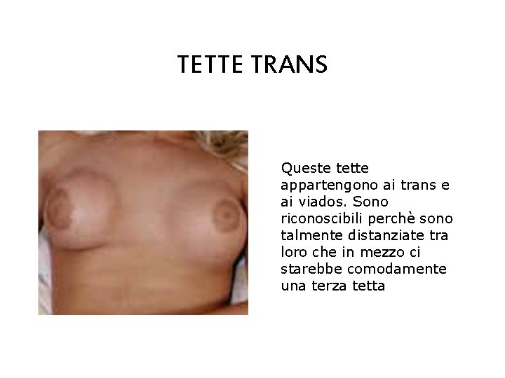 TETTE TRANS Queste tette appartengono ai trans e ai viados. Sono riconoscibili perchè sono