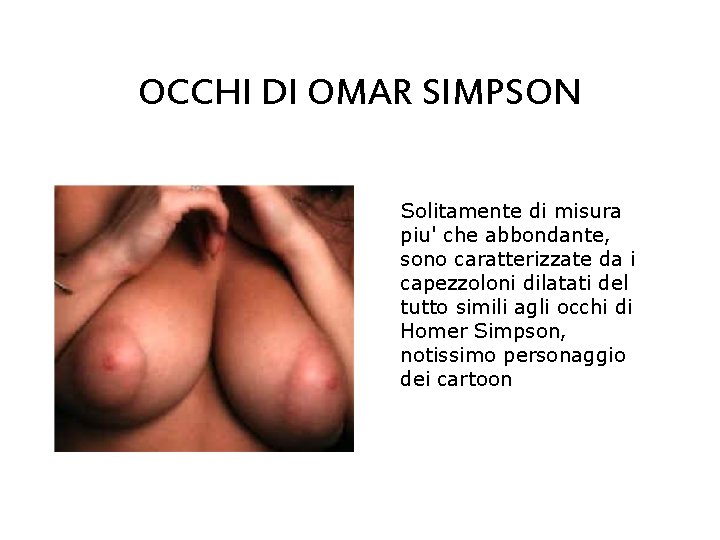 OCCHI DI OMAR SIMPSON Solitamente di misura piu' che abbondante, sono caratterizzate da i