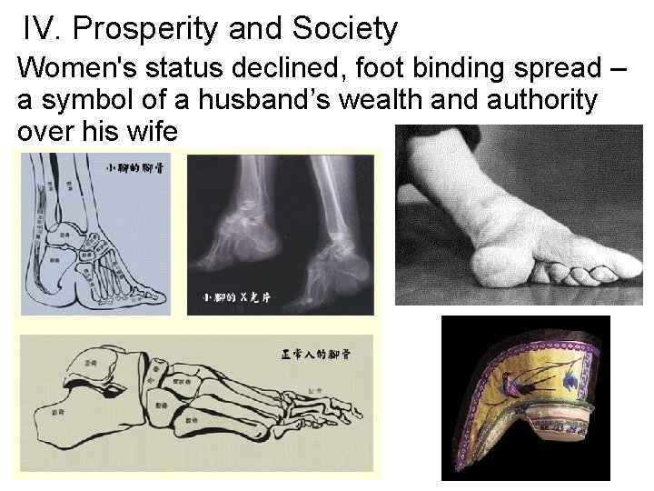 IV. Prosperity and Society Women's status declined, foot binding spread – a symbol of