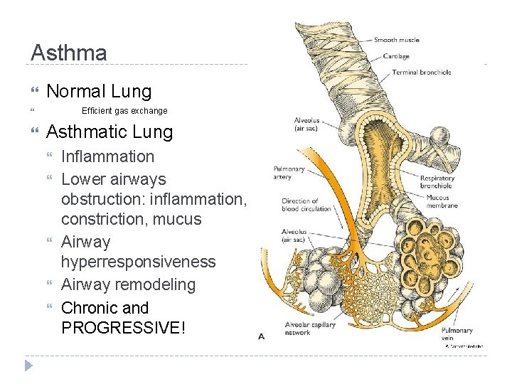 Asthma Normal Lung Efficient gas exchange Asthmatic Lung Inflammation Lower airways obstruction: inflammation, constriction,