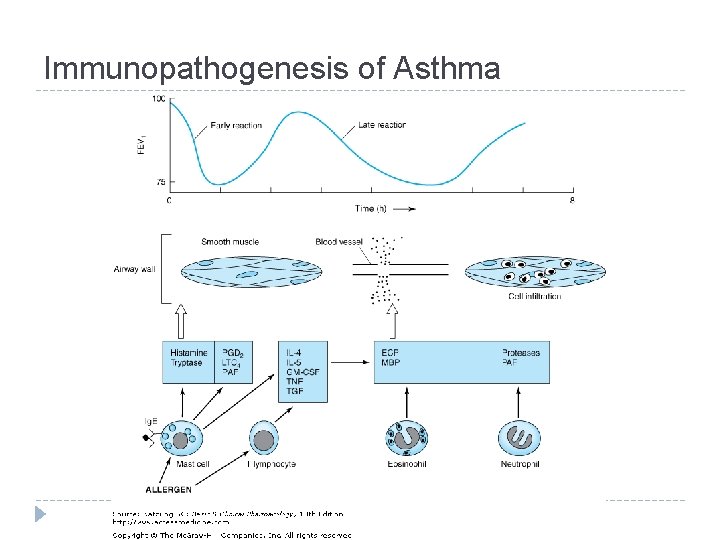 Immunopathogenesis of Asthma 