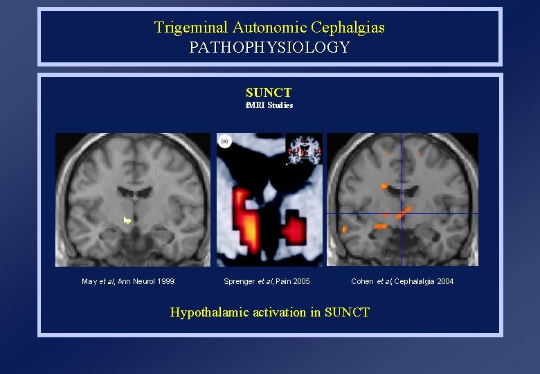 Trigeminal Autonomic Cephalgias PATHOPHYSIOLOGY SUNCT f. MRI Studies May et al, Ann Neurol 1999