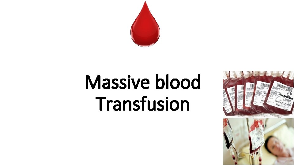 Massive blood Transfusion 