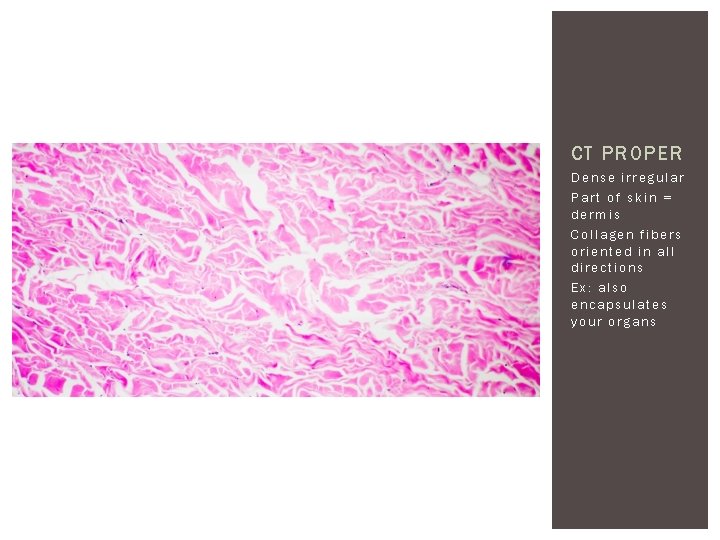 CT PROPER Dense irregular Part of skin = dermis Collagen fibers oriented in all