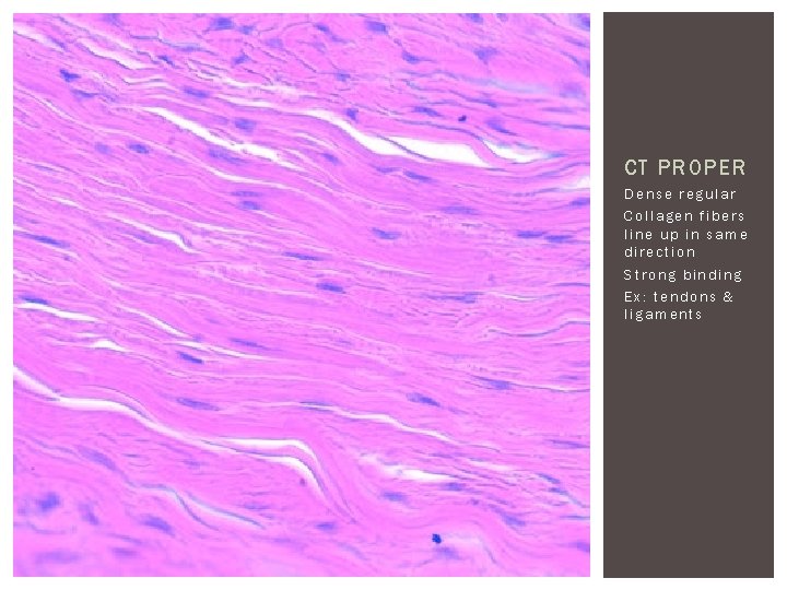 CT PROPER Dense regular Collagen fibers line up in same direction Strong binding Ex:
