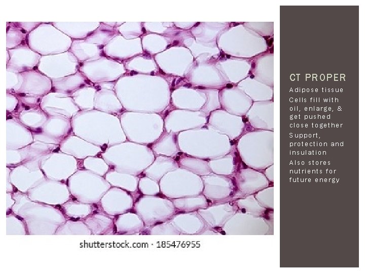 CT PROPER Adipose tissue Cells fill with oil, enlarge, & get pushed close together