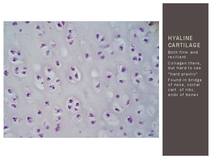 HYALINE CARTILAGE Both firm and resilient. Collagen there, but hard to see “hard plastic”
