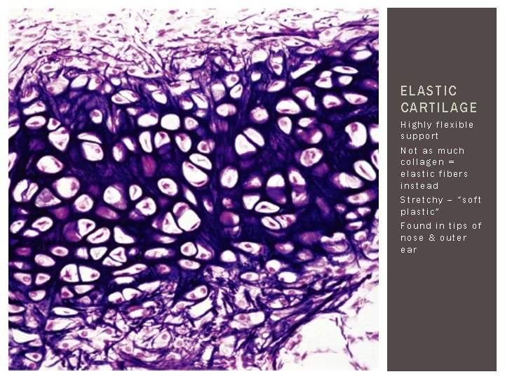 ELASTIC CARTILAGE Highly flexible support Not as much collagen = elastic fibers instead Stretchy