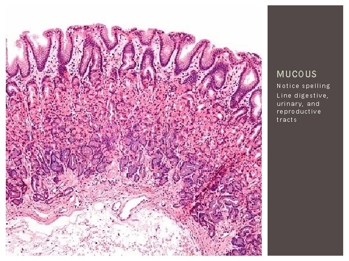 MUCOUS Notice spelling Line digestive, urinary, and reproductive tracts 