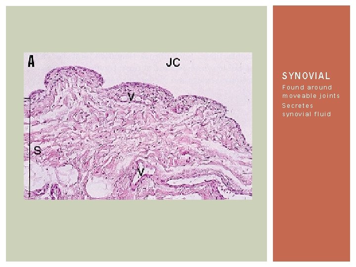 SYNOVIAL Found around moveable joints Secretes synovial fluid 