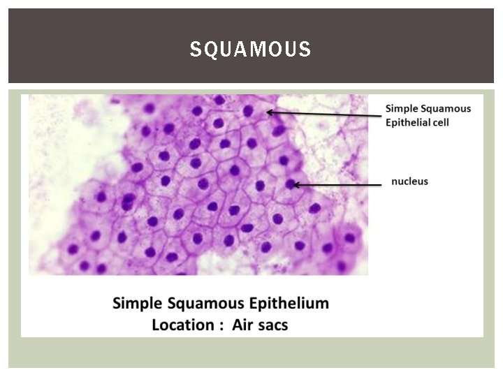 SQUAMOUS 