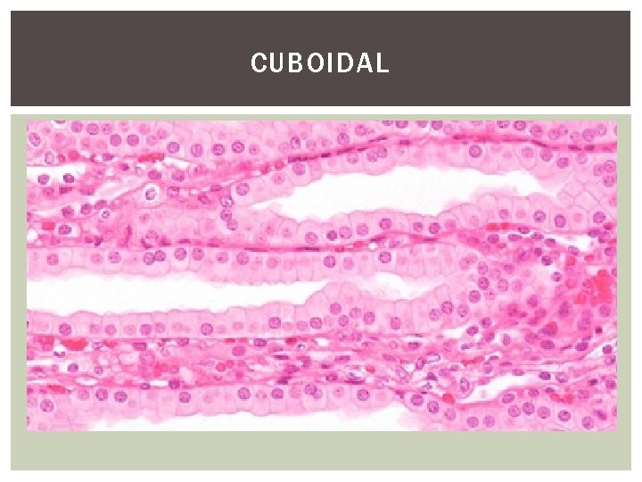 CUBOIDAL 