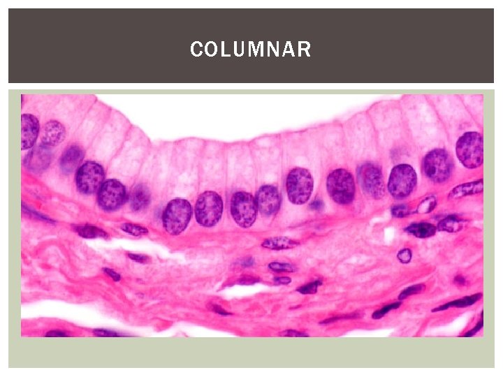 COLUMNAR 