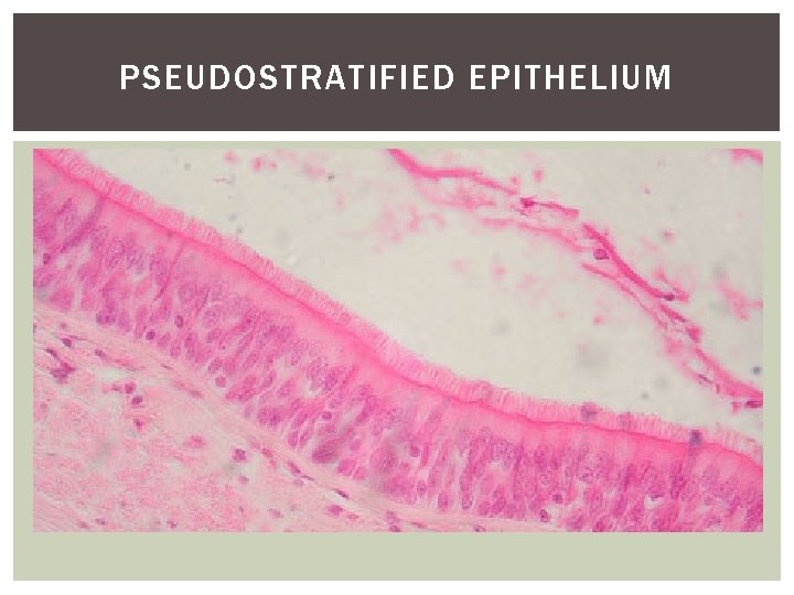 PSEUDOSTRATIFIED EPITHELIUM 