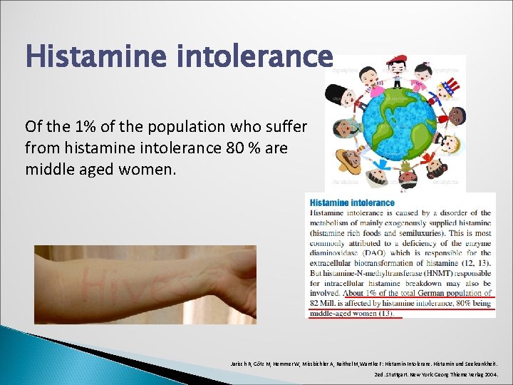 Histamine intolerance Of the 1% of the population who suffer from histamine intolerance 80