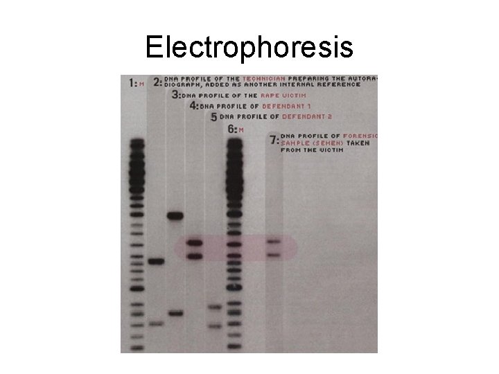 Electrophoresis 