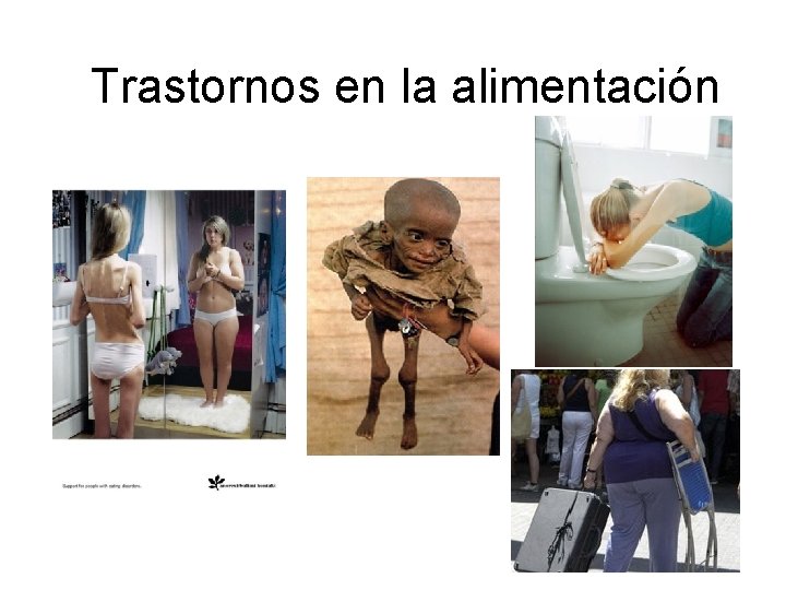 Trastornos en la alimentación 