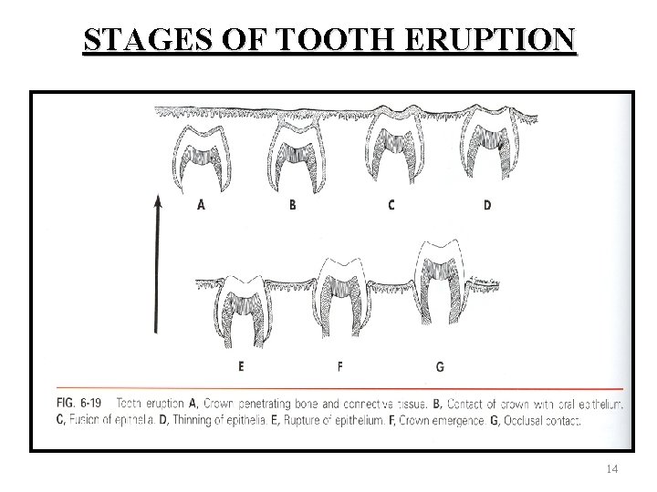 STAGES OF TOOTH ERUPTION 14 