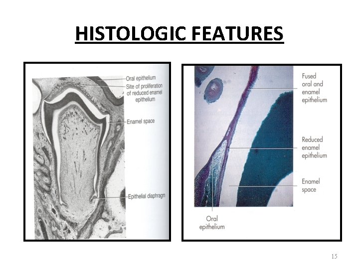 HISTOLOGIC FEATURES 15 