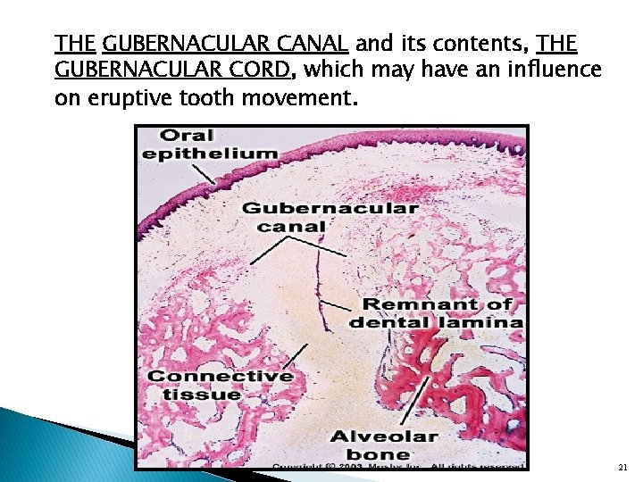 THE GUBERNACULAR CANAL and its contents, THE GUBERNACULAR CORD, which may have an influence