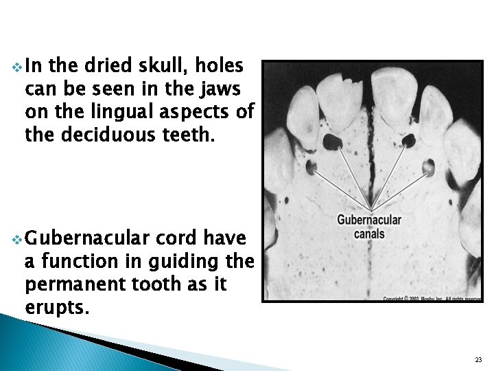 v In the dried skull, holes can be seen in the jaws on the