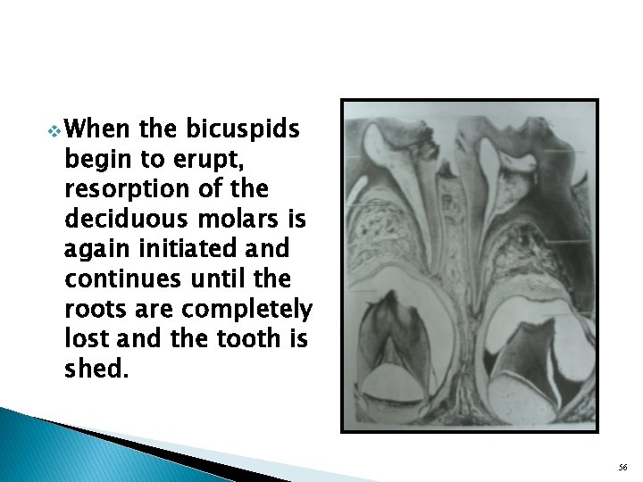 v When the bicuspids begin to erupt, resorption of the deciduous molars is again