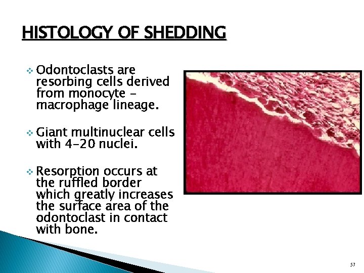 HISTOLOGY OF SHEDDING v v v Odontoclasts are resorbing cells derived from monocyte macrophage