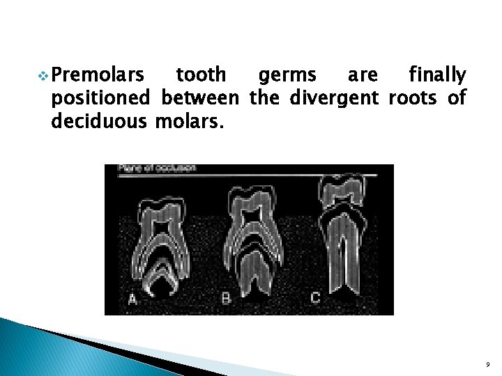 v Premolars tooth germs are finally positioned between the divergent roots of deciduous molars.