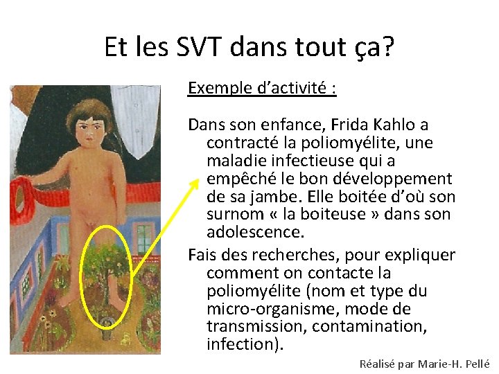 Et les SVT dans tout ça? Exemple d’activité : Dans son enfance, Frida Kahlo