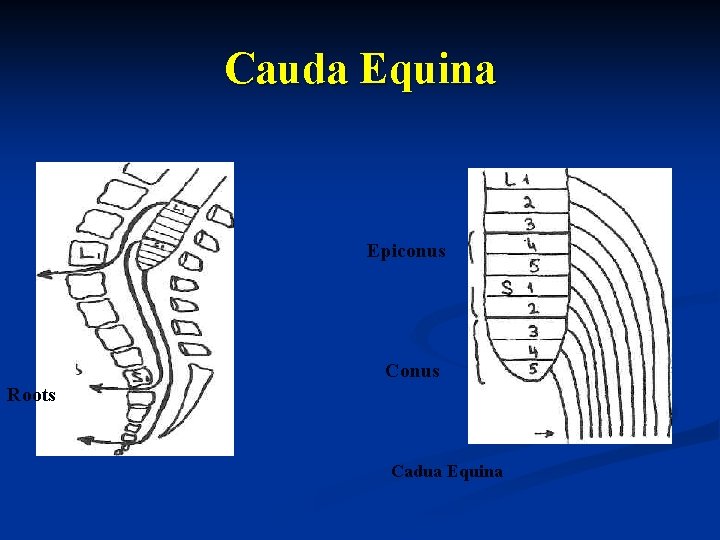 Cauda Equina Epiconus Conus Roots Cadua Equina 