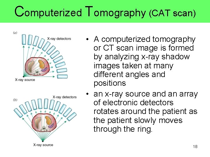Computerized Tomography (CAT scan) • A computerized tomography or CT scan image is formed