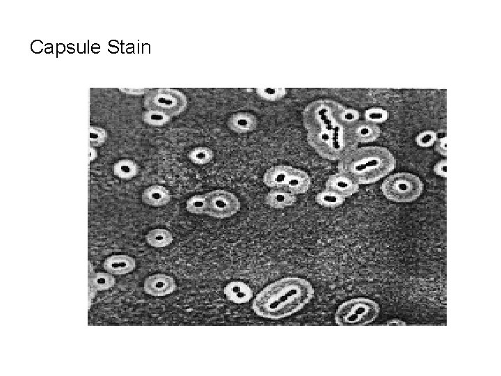 Capsule Stain 