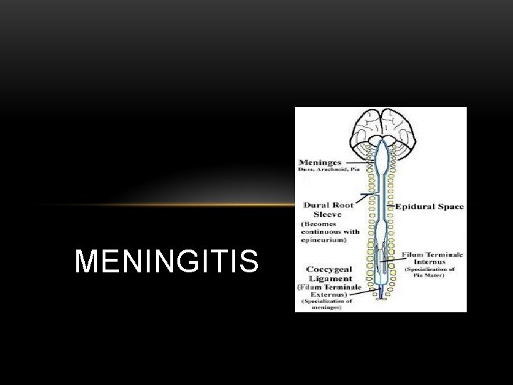 MENINGITIS 