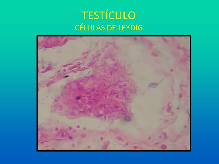 TESTÍCULO CÉLULAS DE LEYDIG 