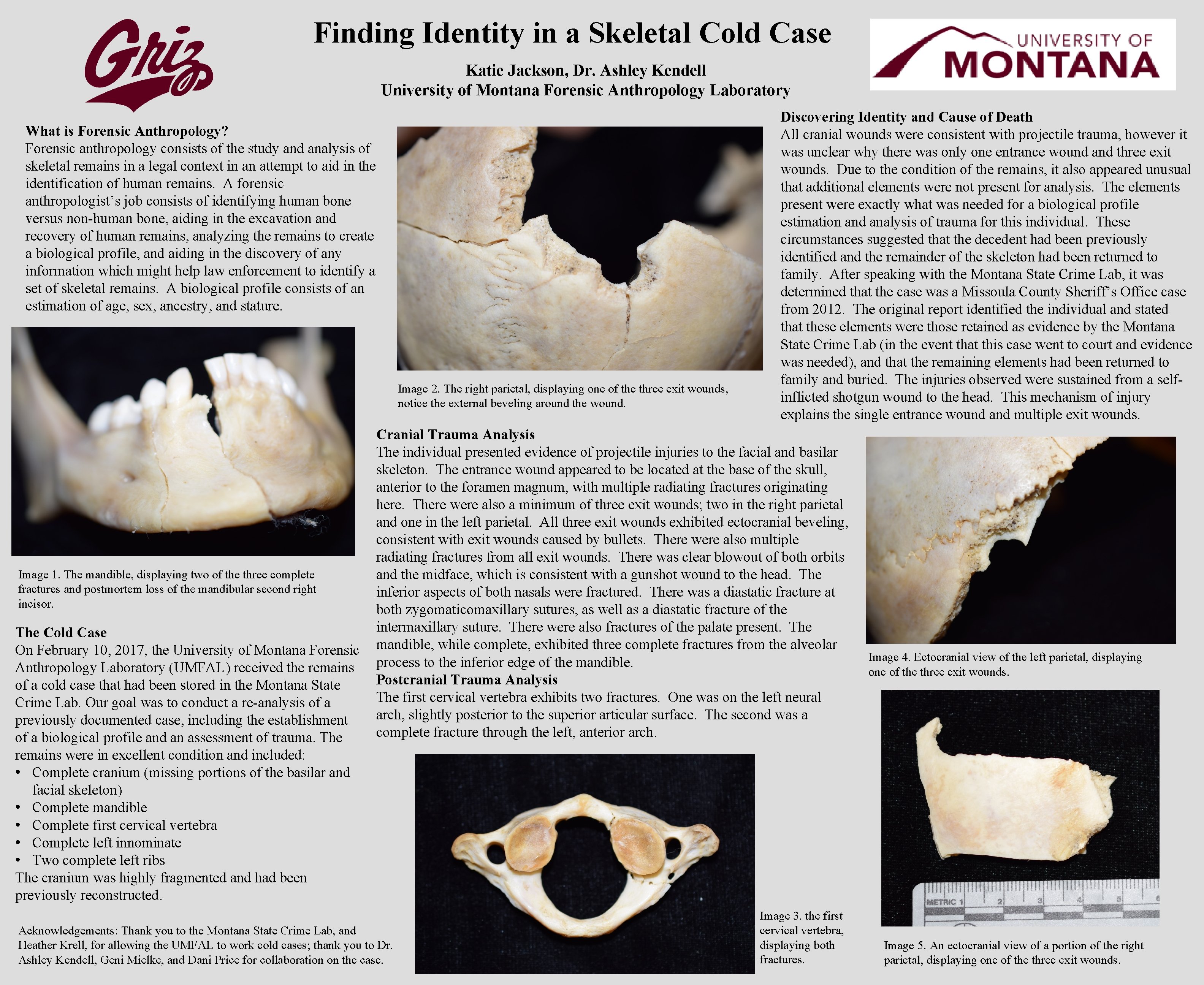 Finding Identity in a Skeletal Cold Case Katie Jackson, Dr. Ashley Kendell University of Finding Identity in a Skeletal Cold Case Katie Jackson, Dr. Ashley Kendell University of