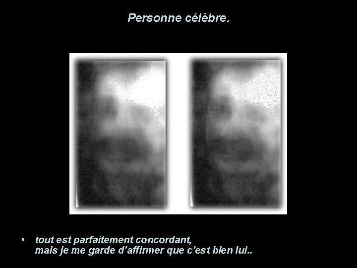 Personne célèbre. • tout est parfaitement concordant, mais je me garde d’affirmer que c’est