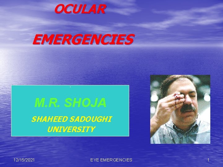 OCULAR EMERGENCIES. M. R. SHOJA SHAHEED SADOUGHI UNIVERSITY 12/15/2021 EYE EMERGENCIES 1 